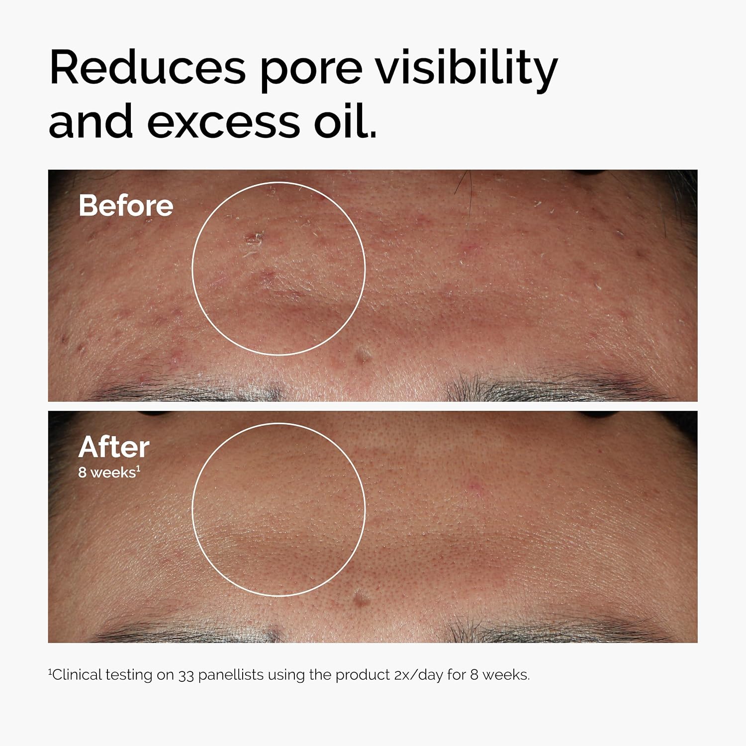 Niacinamide 5% to 20%: The Concentration Guide Your Skin Actually Needs